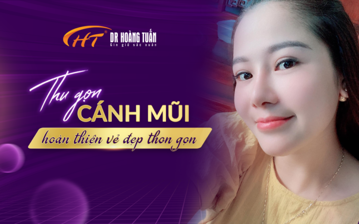 Thu gọn cánh mũi hoàn thiện vẻ đẹp thon gọn Thẩm mỹ Hoàng Tuấn